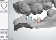 CAD CAM